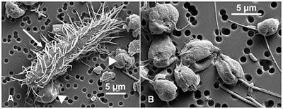 Single-Cell View of Carbon and Nitrogen Acquisition in the Mixotrophic Alga Prymnesium parvum (Haptophyta) Inferred From Stable Isotope Tracers and NanoSIMS